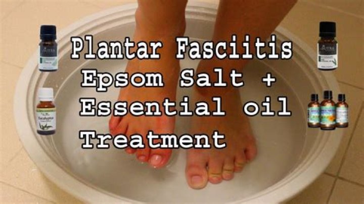 Will Epsom salt help plantar fasciitis?
